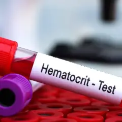 Wysoki hematokryt: Niebezpieczny znak dla kolarzy? Wyjaśniamy